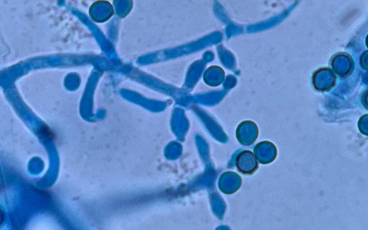 Rhizobacteriën en Trichoderma